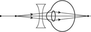cbe-science-10-ch-10-q-6-b