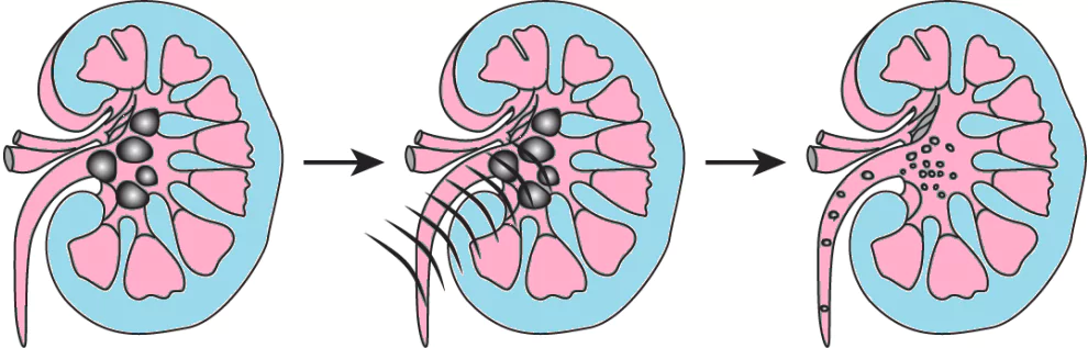 cbe-questions-science-class-9-ch-11-q-17