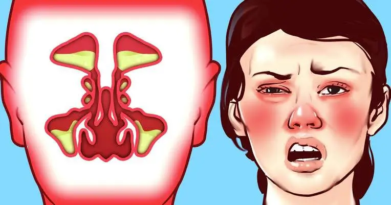 Why does Nose plug up when we cry?