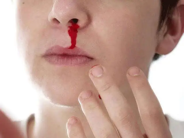 Why does the Nose of some people start bleeding at Higher altitude?
